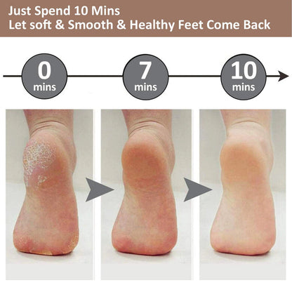 Electric Callus Remover